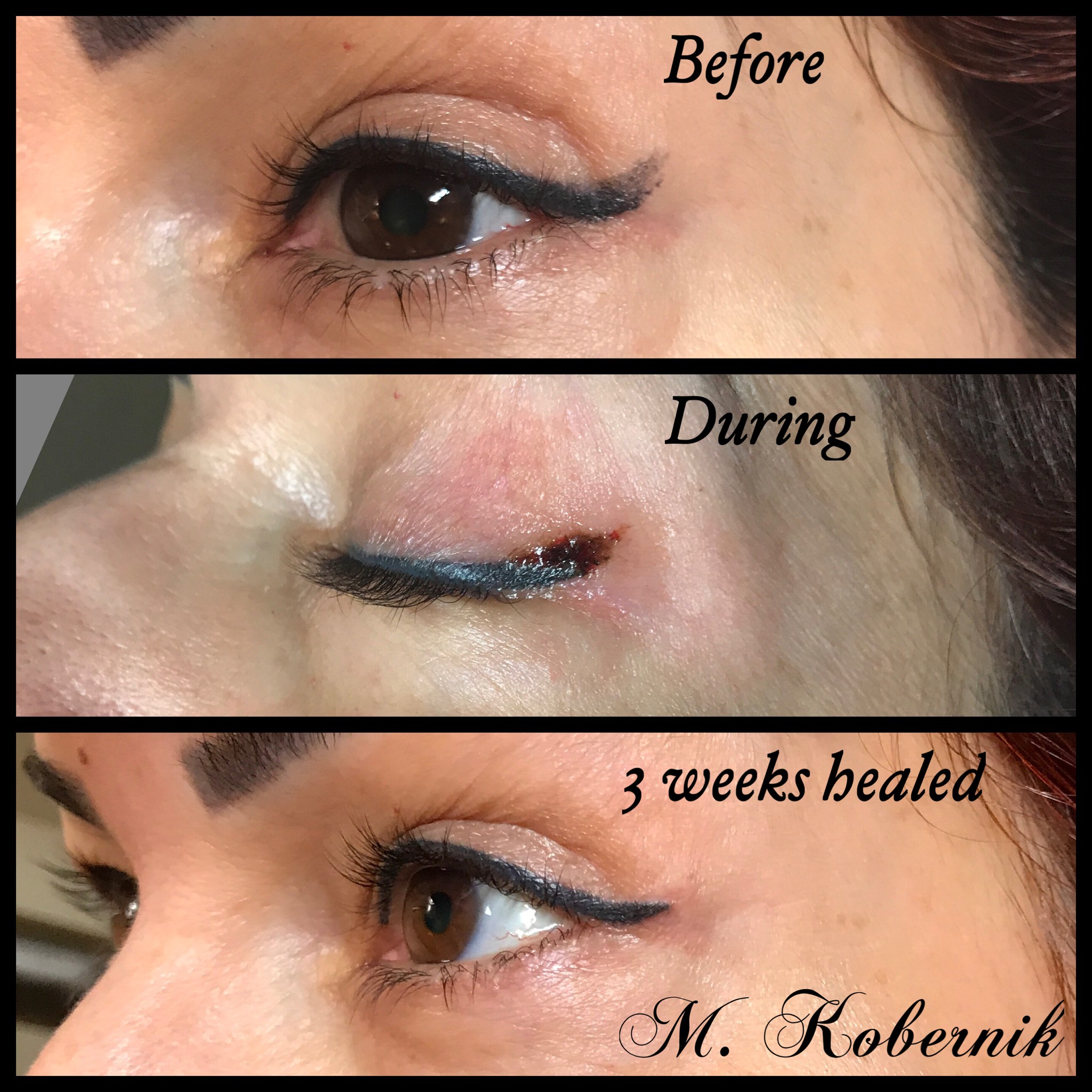 Wie man dauerhafte Kosmetik entfernt (einschließlich schlechtem Microblading) 