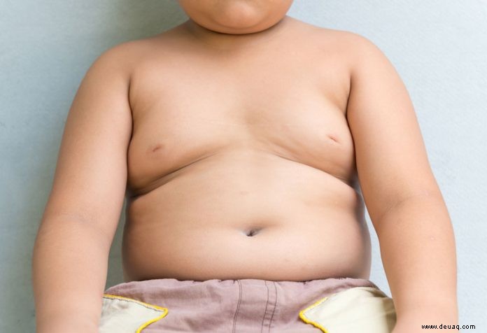 Fettleibigkeit bei Kindern 