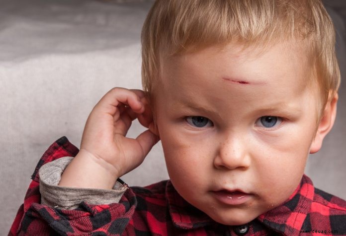 Kopfverletzungen bei Kindern 
