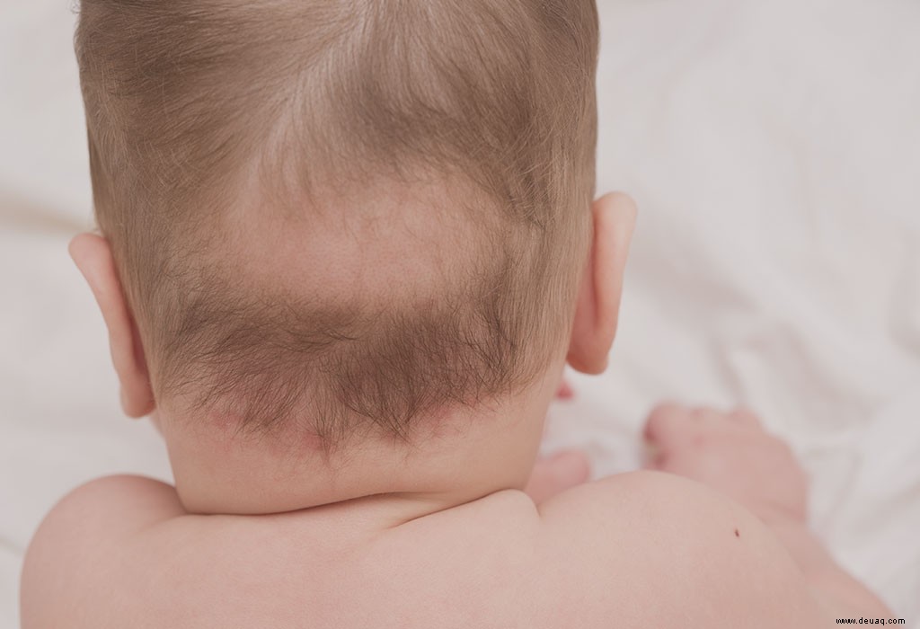 Kopfhautprobleme bei Kindern – Arten, Ursachen und Behandlung 