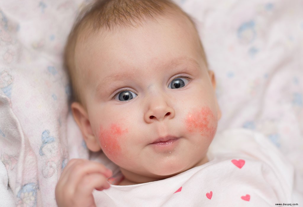 Apfelessig für Babys und Kinder 