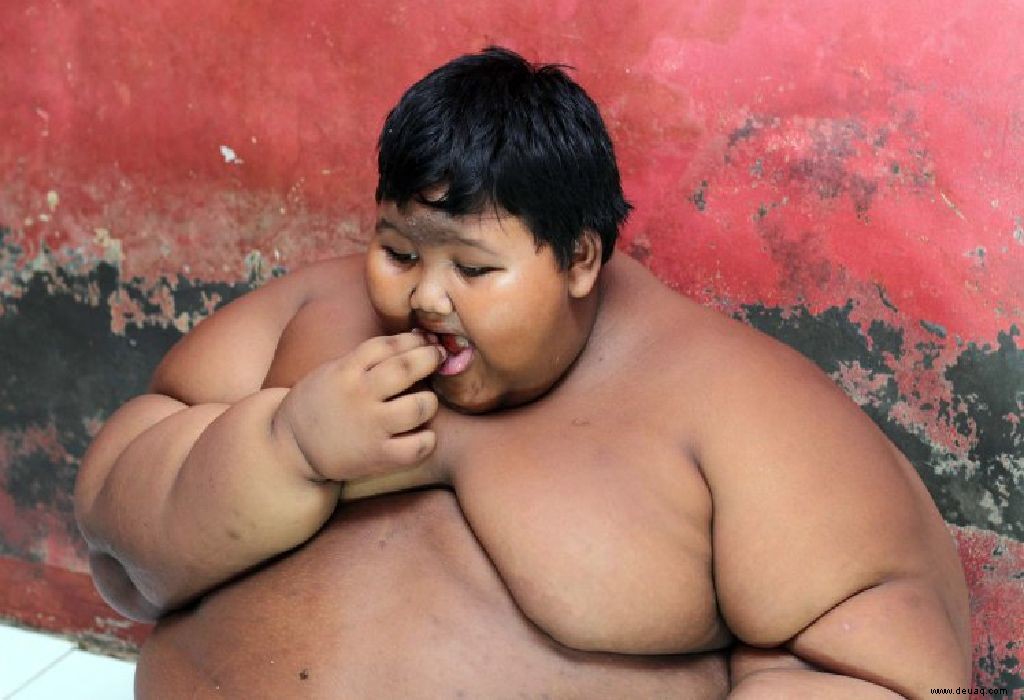 Dieser 10-jährige Junge wiegt aufgrund einer ungesunden Essgewohnheit 190 kg! Eltern, wir müssen gewarnt sein… 