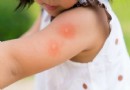 4 Tageszeiten, an denen Kinder einem maximalen Risiko für durch Mücken übertragene Krankheiten ausgesetzt sind 