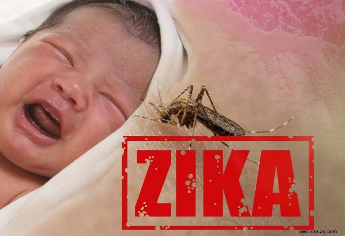 Zika-Virus-Infektion bei Kindern 