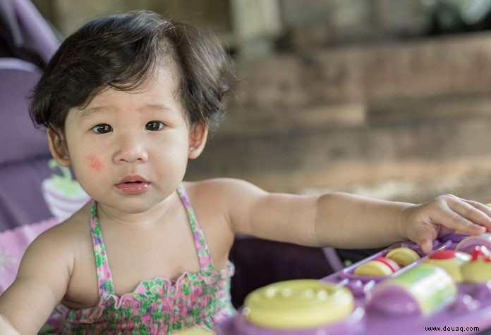 Hausmittel zum Entfernen weißer Flecken im Gesicht von Babys und Kindern 