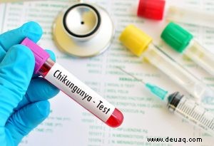 Chikungunya bei Kindern 