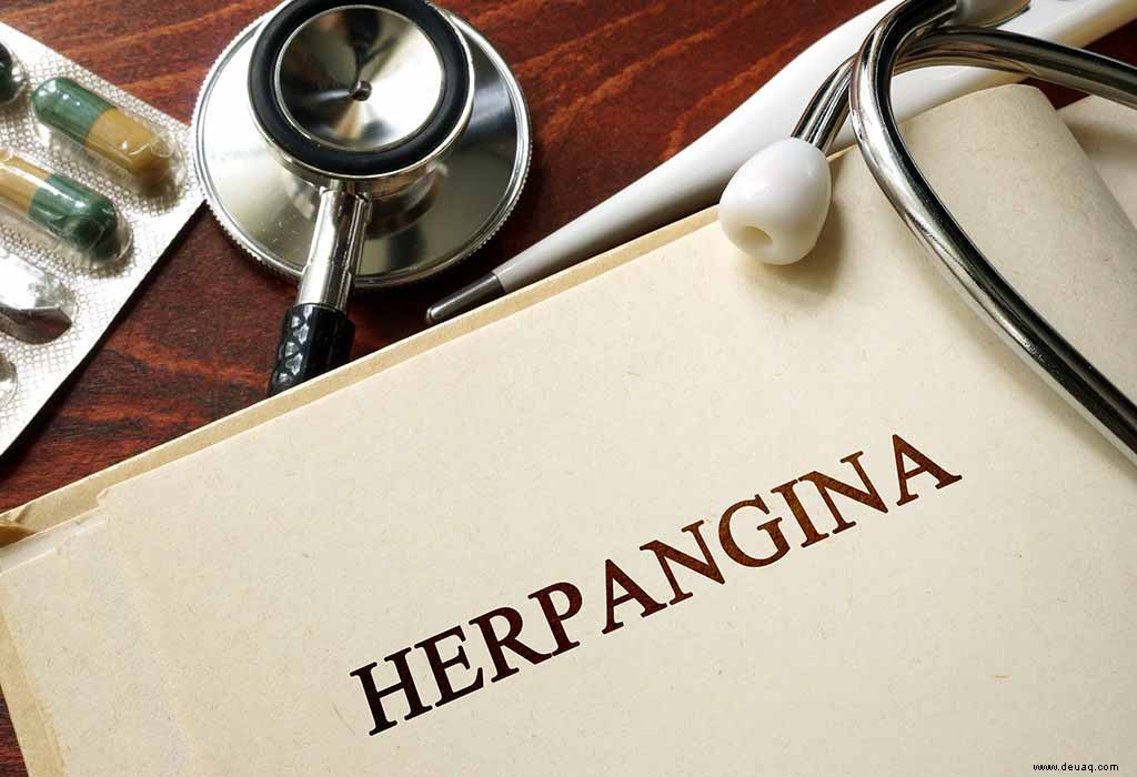 Herpangina bei Kindern – Ursachen, Symptome und Behandlung 