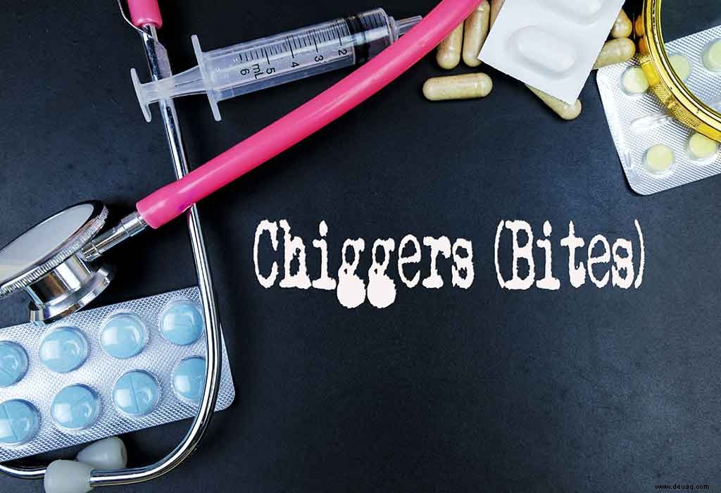 Chigger Bites bei Kindern:Ursachen, Behandlung und Abhilfe 