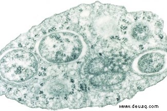 10 tödliche Parasiten 