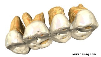 Neue Art von winzigen Homininen auf den Philippinen entdeckt 