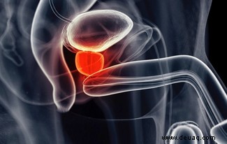 Die Immuntherapie bei Prostatakrebs bietet „Super-Respondern“ viele Lebensjahre 