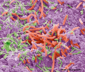 Chlorhexidin-Mundwasser erhöht den Säuregehalt im Mund, indem es das orale Mikrobiom reduziert 