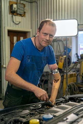 Gedankengesteuerter bionischer Arm mit Tastsinn „könnte in zwei Jahren erhältlich sein“ 