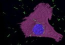 Mikroskopisch kleine Goldröhrchen könnten die Behandlung von asbestbedingtem Krebs verbessern 