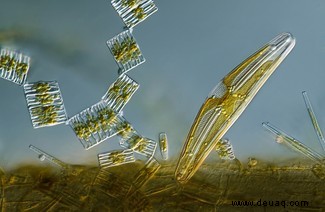 20 atemberaubende Mikroskopfotos vom Wettbewerb Nikon Small World 2020 