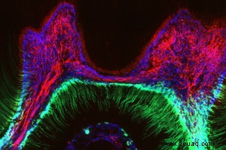 Empfindliche Zähne? Wissenschaftler entdecken, warum kalte Getränke und Eiscreme so schmerzhaft sein können 