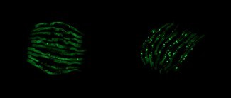 Wissenschaftler identifizieren Darmbakterien, die mit neurodegenerativen Erkrankungen in Verbindung stehen 