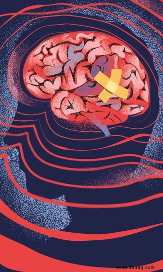 Neuroplastizität:Ein Neurologe erklärt, wie sich das Gehirn von einer Verletzung erholt 