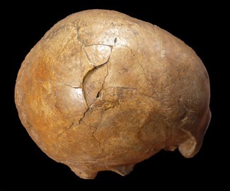 Beweise für brutalen 33.000 Jahre alten Mord auf versteinertem Schädel gefunden 