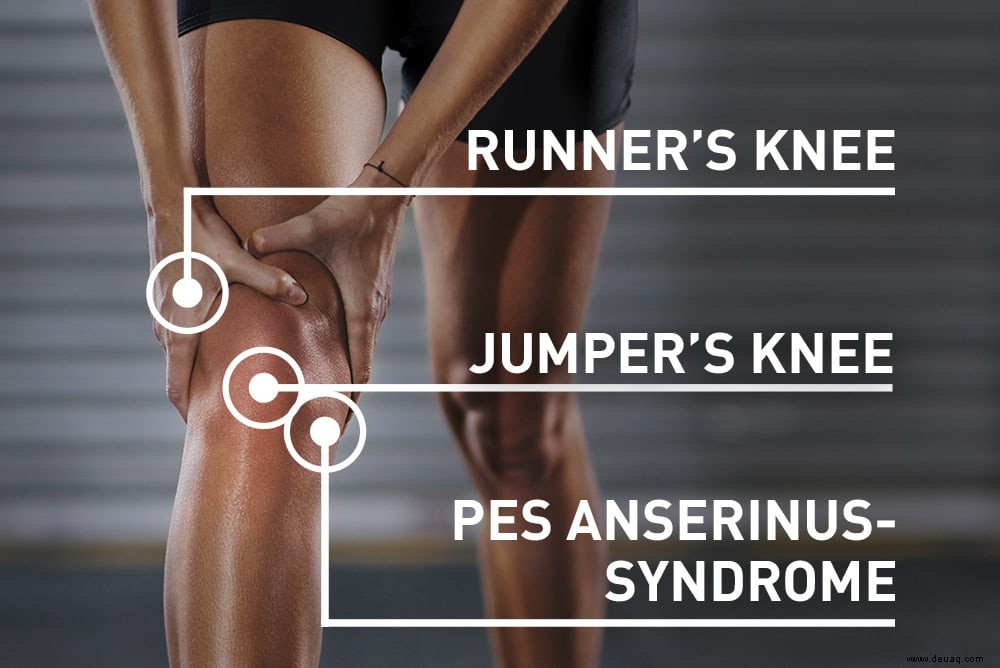 Welche Knieprobleme haben Sie? Überprüfen Sie Ihre Symptome! 