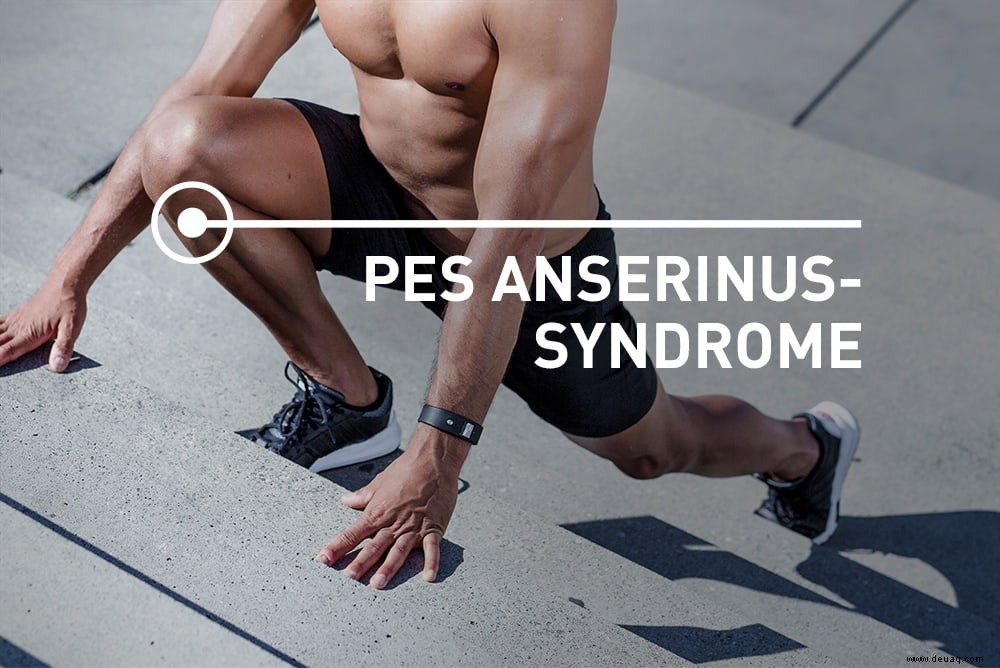 Pes-Anserinus-Syndrom:3 Übungen zur Behandlung von medialen Knieschmerzen 