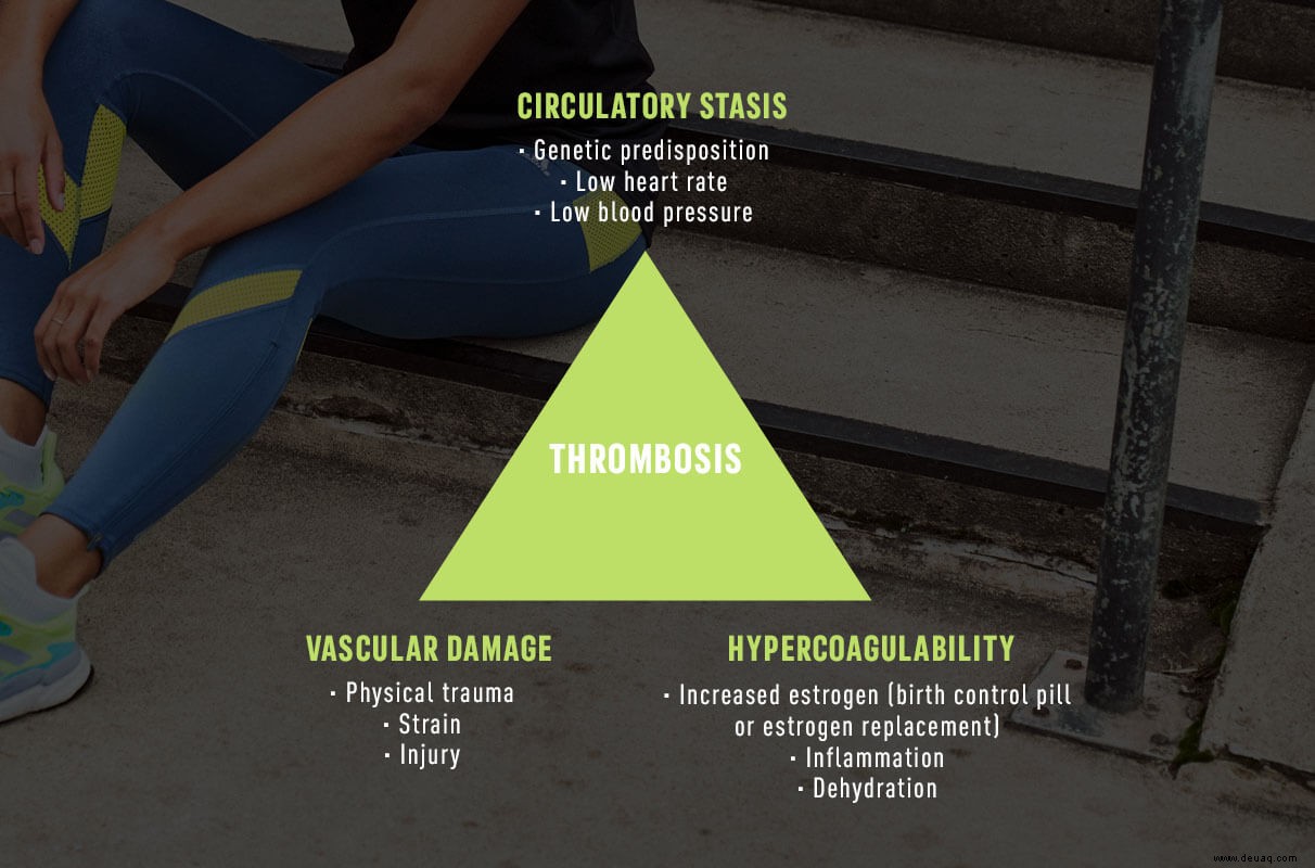 Das Risiko von Läufern für Blutgerinnsel in den Beinen und wie man TVT-Symptome erkennt 