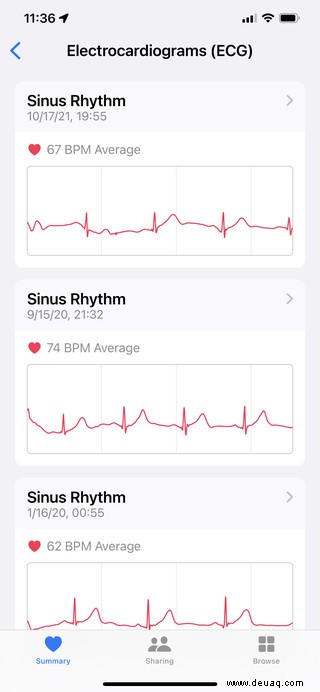 So messen Sie die Herzfrequenz auf Ihrer Smartwatch 