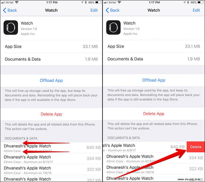 So löschen Sie Apple Watch-Backups vom iPhone 