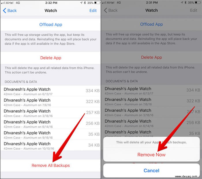 So löschen Sie Apple Watch-Backups vom iPhone 