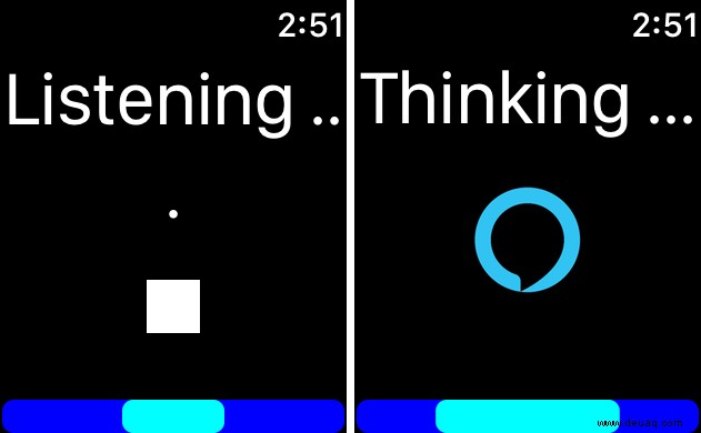 So verwenden Sie Alexa auf der Apple Watch 