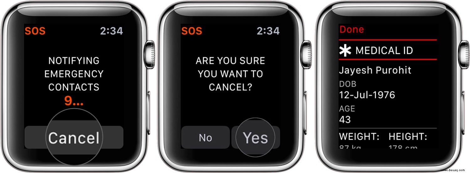 So verwenden Sie Notfall-SOS auf der Apple Watch 