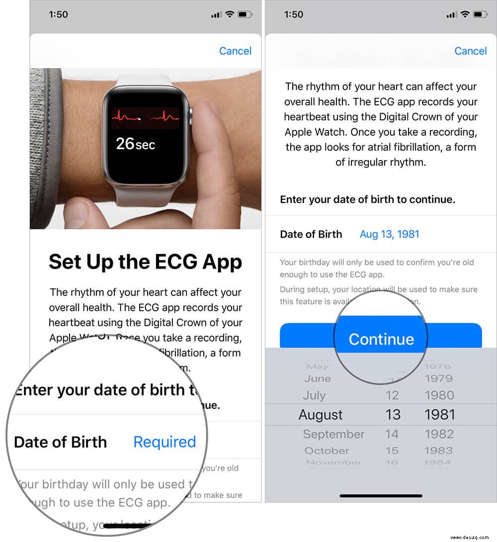 Einrichten und Verwenden von EKG auf der Apple Watch (Serie 4 oder 5) 