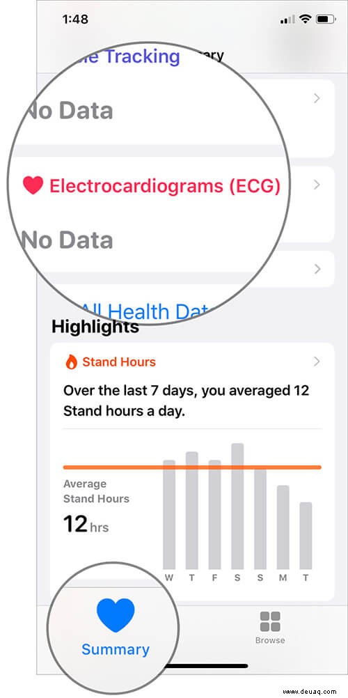 Einrichten und Verwenden von EKG auf der Apple Watch (Serie 4 oder 5) 