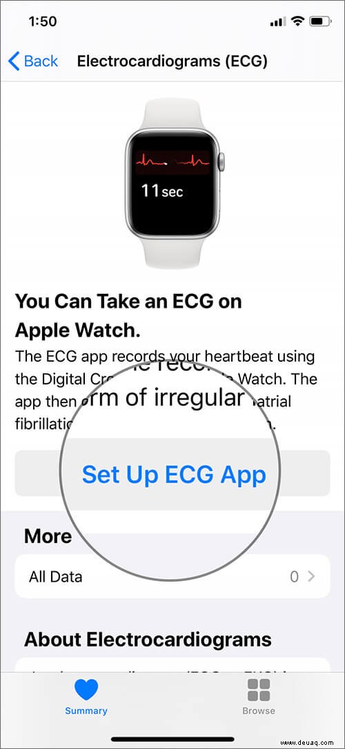 Einrichten und Verwenden von EKG auf der Apple Watch (Serie 4 oder 5) 