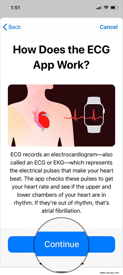 Einrichten und Verwenden von EKG auf der Apple Watch (Serie 4 oder 5) 