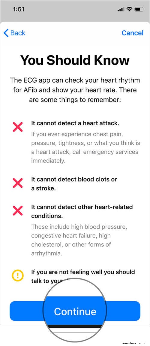 Einrichten und Verwenden von EKG auf der Apple Watch (Serie 4 oder 5) 