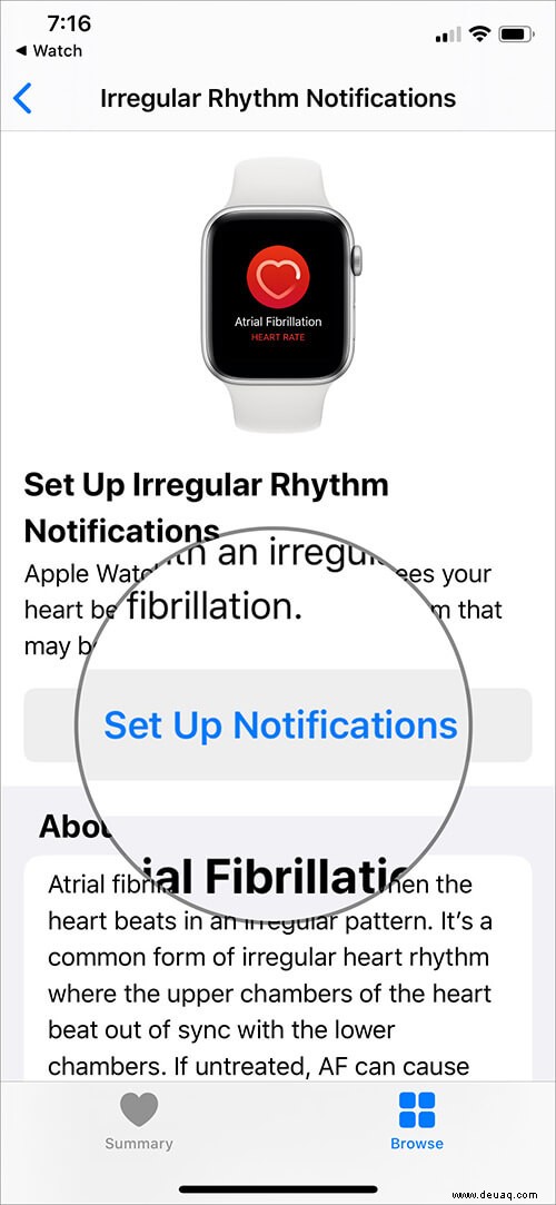 Einrichten und Verwenden von EKG auf der Apple Watch (Serie 4 oder 5) 
