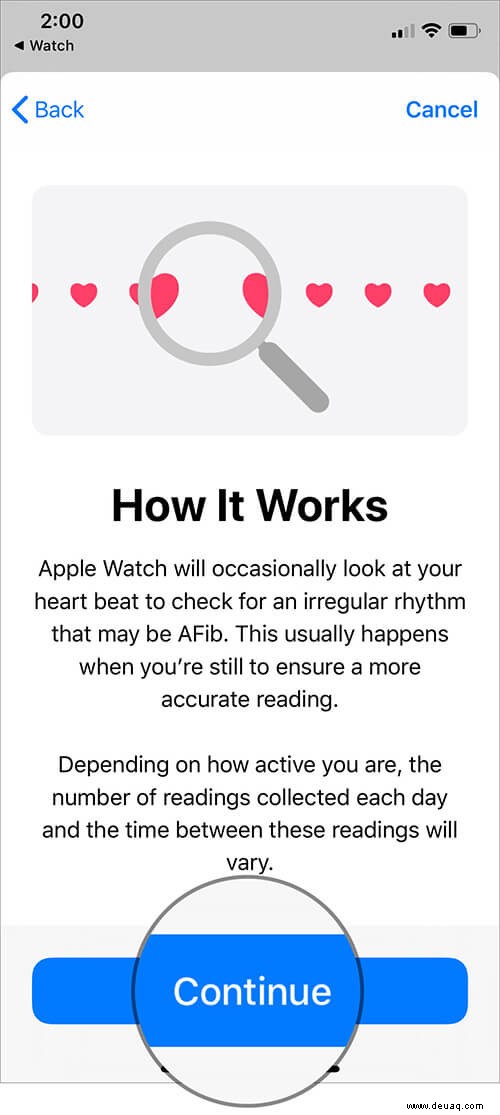 Einrichten und Verwenden von EKG auf der Apple Watch (Serie 4 oder 5) 