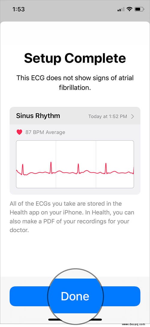 Einrichten und Verwenden von EKG auf der Apple Watch (Serie 4 oder 5) 