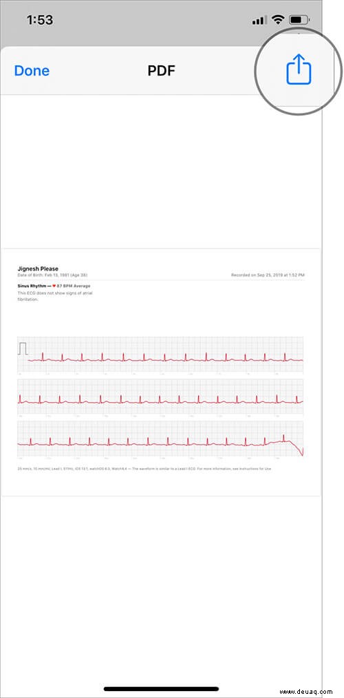 Einrichten und Verwenden von EKG auf der Apple Watch (Serie 4 oder 5) 