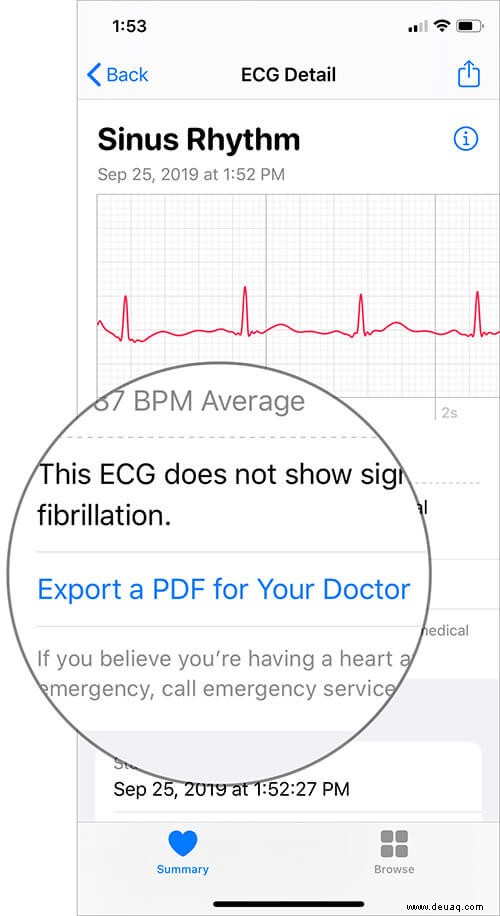 Einrichten und Verwenden von EKG auf der Apple Watch (Serie 4 oder 5) 