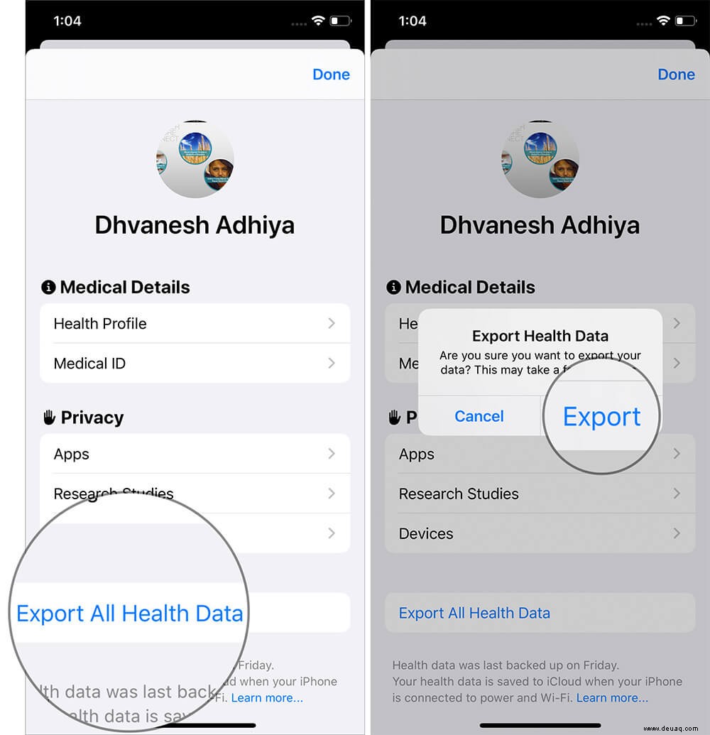 So exportieren Sie Gesundheitsdaten von Ihrem iPhone 