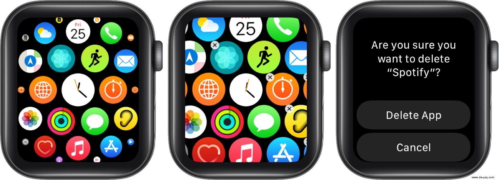 So geben Sie Speicherplatz auf der Apple Watch frei:Ultimative Anleitung 