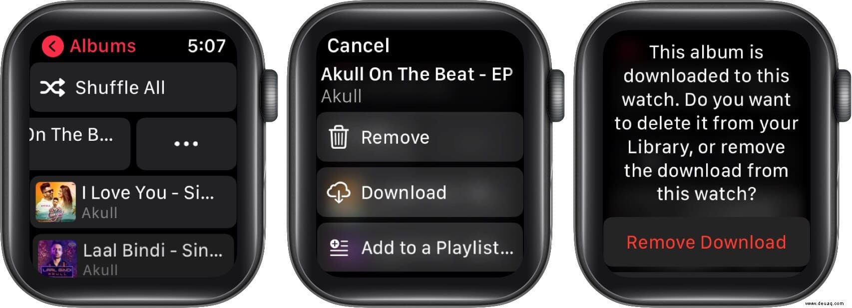 So geben Sie Speicherplatz auf der Apple Watch frei:Ultimative Anleitung 