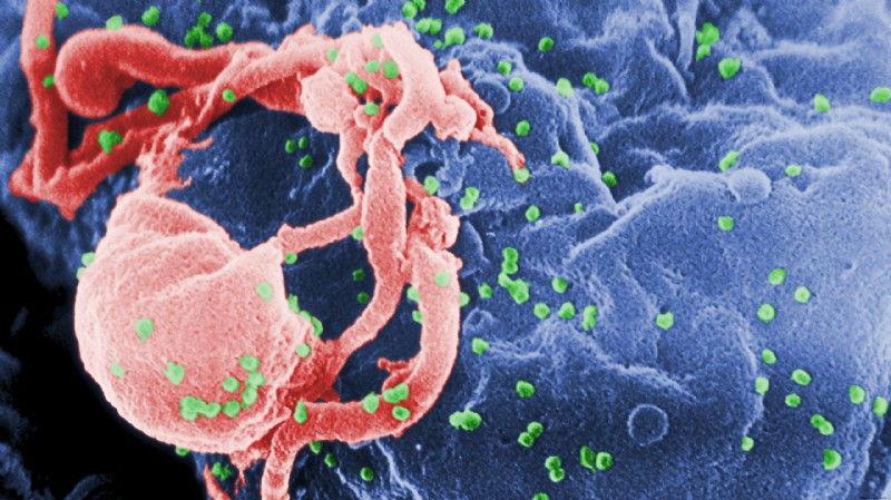 Wissenschaftler entwickeln einen „Drei-in-einem“-Antikörper, der 99 % der HIV-Stämme angreift
