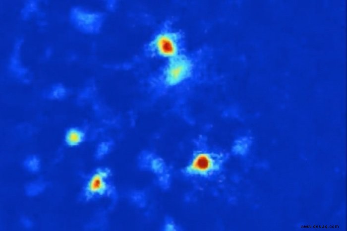 Wissenschaftler haben einen Weg gefunden, Angstzustände „auszuschalten“, indem sie auf Zellen im Gehirn abzielen