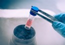 Eine bahnbrechende Stammzelltherapie könnte Millionen Menschen mit MS Hoffnung geben 