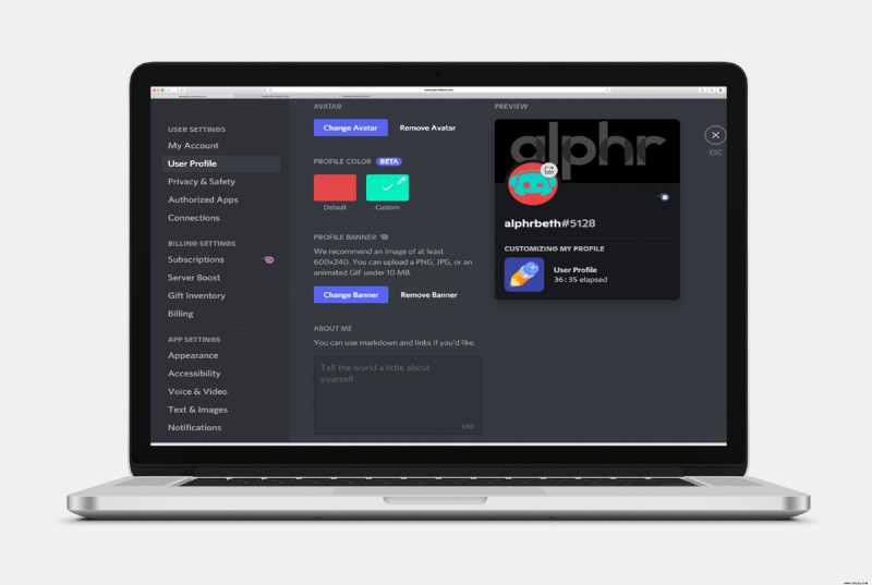 So fügen Sie das Profilbanner in Discord hinzu oder ändern es