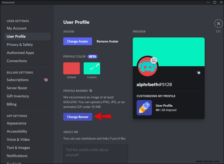 So fügen Sie das Profilbanner in Discord hinzu oder ändern es